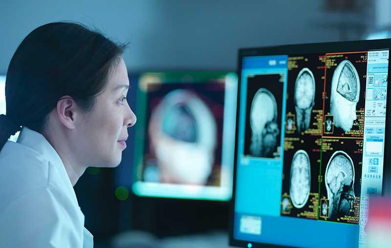 女性医学研究员看着监视器上的脑部扫描图